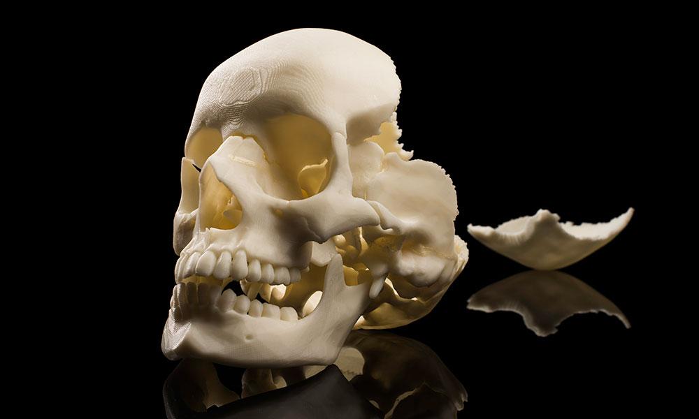 由3D打印材料制成的人类头骨特写.
